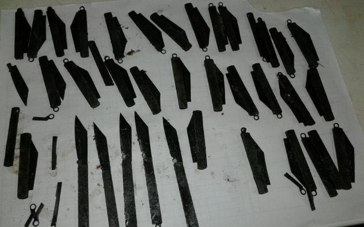 106370657-knives-removed-from-man-large_transEDjTm7JpzhSGR1_8ApEWQA1vLvhkMtVb21dMmpQBfEs
