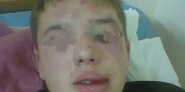 Резонанс с избиением подростка в Корабельном районе: нападавшие никакого отношения к милиции не имеют, расследование продолжается