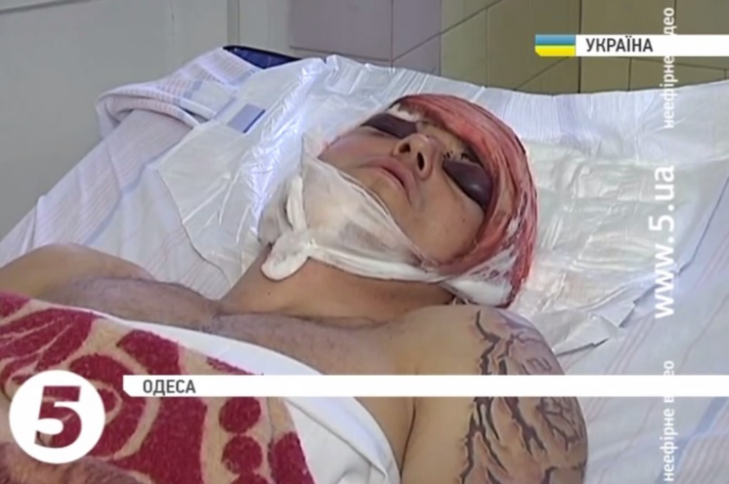 В Одессе жестоко избили волонтера 1