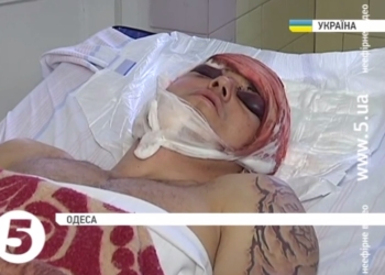 В Одессе жестоко избили волонтера