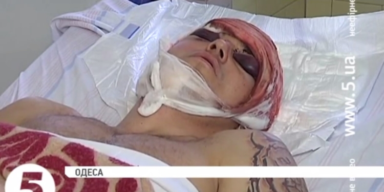 В Одессе жестоко избили волонтера