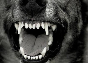 Николаев, внимание: искусанной бойцовыми собаками девочке нужны доноры