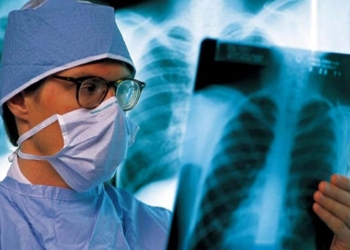 Лучше, но недостаточно: в Николаевской области туберкулезом болеют меньше