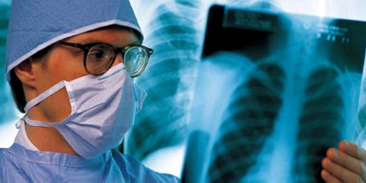 Лучше, но недостаточно: в Николаевской области туберкулезом болеют меньше