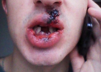 “Стрелка” устроившего беспредел в “Комадоре” отпустили под залог