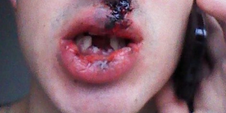 “Стрелка” устроившего беспредел в “Комадоре” отпустили под залог