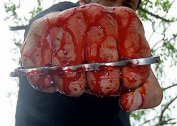 Милиция разыскивает злоумышленников, избивших николаевского журналиста