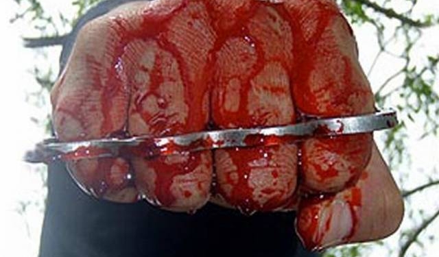 Милиция разыскивает злоумышленников, избивших николаевского журналиста