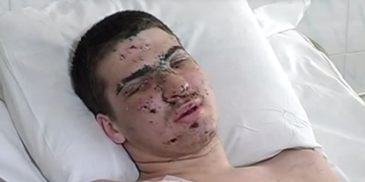 20-летний Александр Попруженко накрыл собой гранату с выдернутой чекой и спас 30 мобилизованных. Теперь ему самому нужна помощь