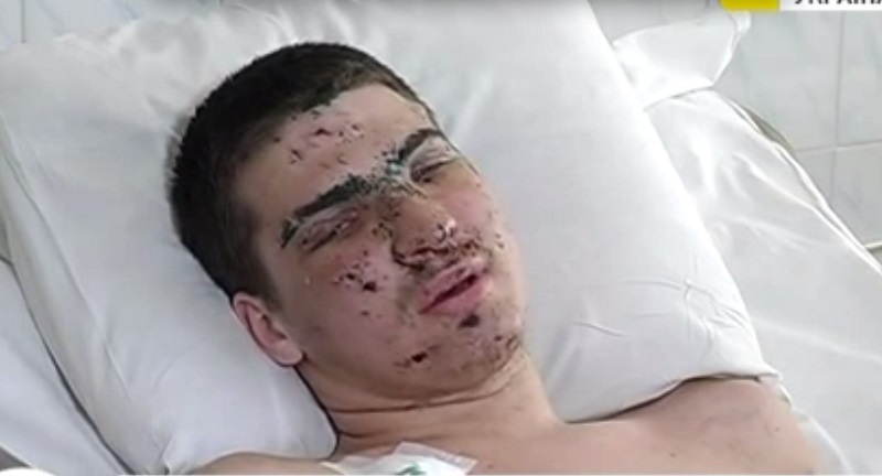 Украдены 100 тыс.грн., которые украинцы собрали для раненого Александра Попруженко, спасшего 30 мобилизованных 2