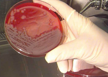 Военные США по ошибке разослали споры сибирской язвы