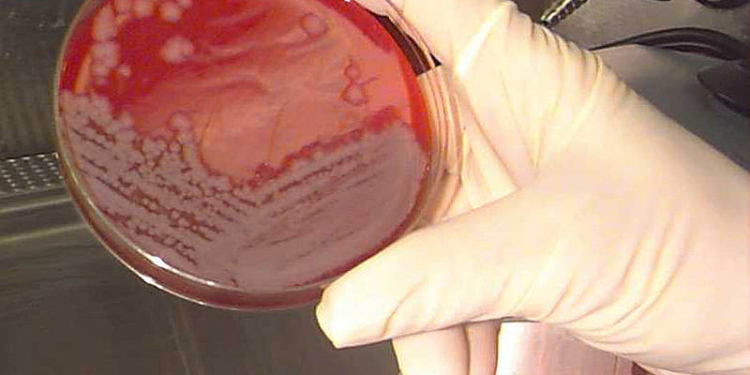 Военные США по ошибке разослали споры сибирской язвы