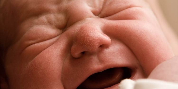 Почему в Очаковской ЦРБ новорожденному сломали ногу, разберется прокуратура