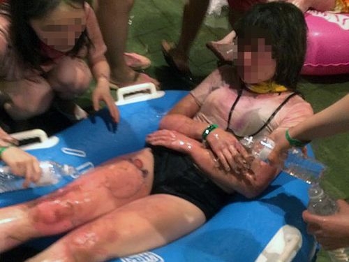 В аквапарке на Тайване произошел объемный взрыв дыма: более 400 пострадавших с ожогами, один погиб