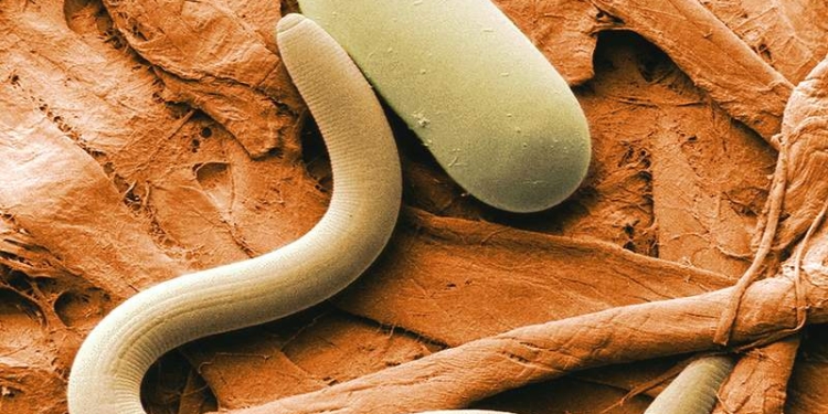 В Николаевской области семья после употребления шашлыков заболела трихиннелезом