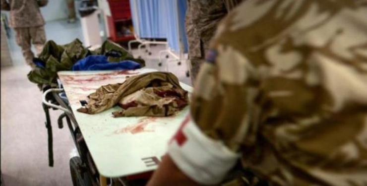 Против Украины воюют садисты. Врачи шокированы тем, как пытали нашего бойца в плену