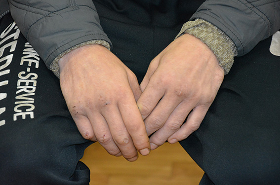 В Николаеве 36-летний металлической трубой и деревянной палкой забил до смерти 65-летнего мужчину