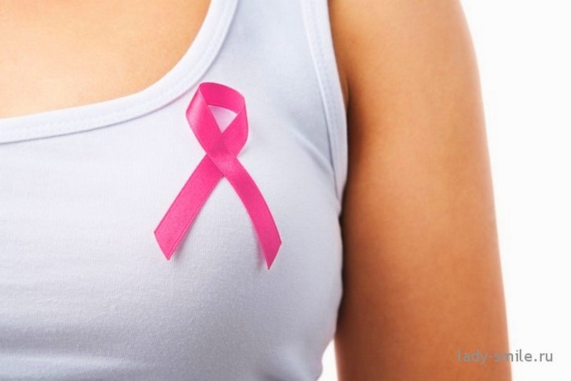 «Дни открытых дверей» в лечебных учреждениях Николаевской области: из осмотренных почти 54 тысяч женщин у 81-й обнаружен рак груди 1