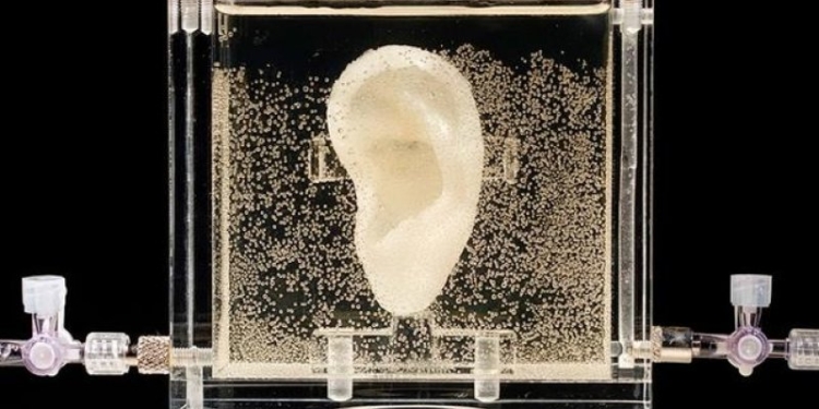 При помощи ДНК и компьютера воссоздали ухо Ван Гога