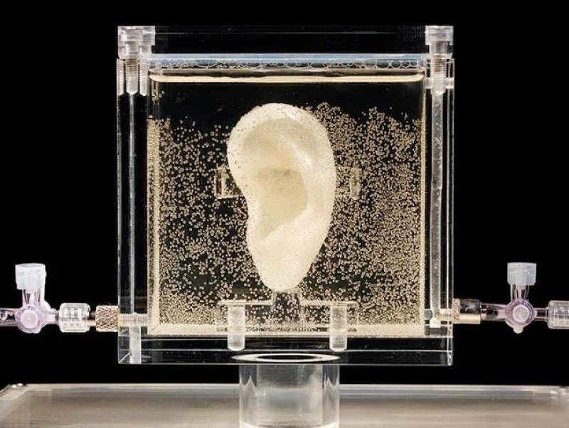 При помощи ДНК и компьютера воссоздали ухо Ван Гога 1