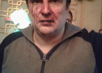 В Днепропетровске милиционер с “дружками” избили двух мужчин: рассказ потерпевшего