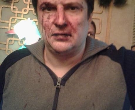 В Днепропетровске милиционер с “дружками” избили двух мужчин: рассказ потерпевшего