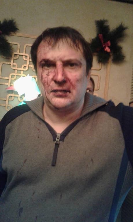 В Днепропетровске милиционер с "дружками" избили двух мужчин: рассказ потерпевшего 1