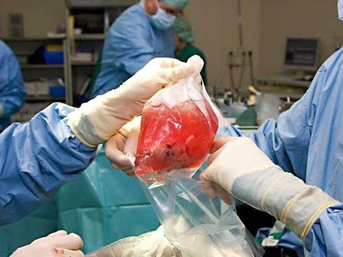 Официально. В ДНР намерены торговать органами пленных