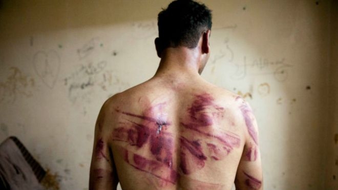 ООН обвиняет власти Сирии в массовых пытках и убийствах заключенных