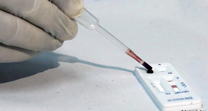 Ученый: Вирус Зика не нужно сравнивать с ВИЧ/СПИДом