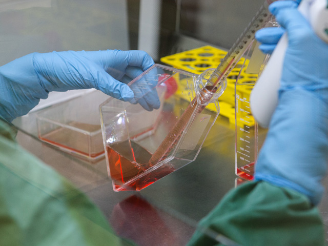 Похож на Эболу: ученые обнаружили новый смертельный вирус 1