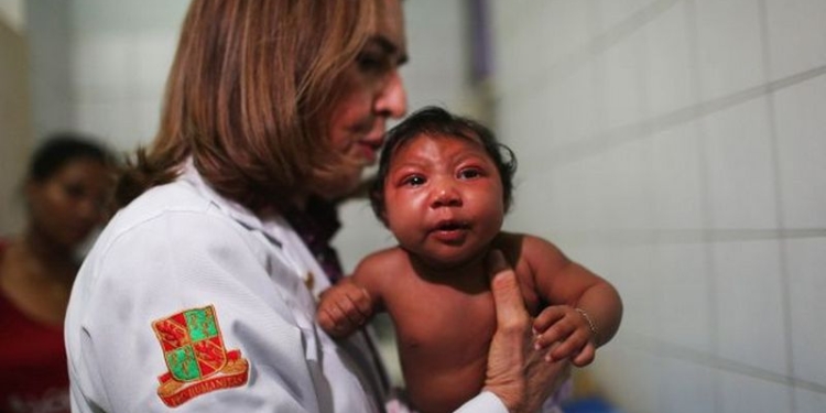 В Чили зафиксирован первый случай передачи вируса Зика половым путем