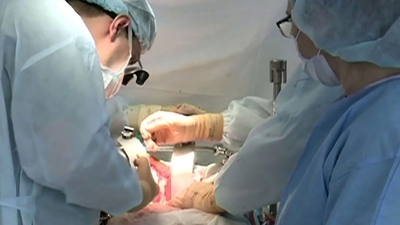 В Украине проведена  первая пересадка механического сердца 1