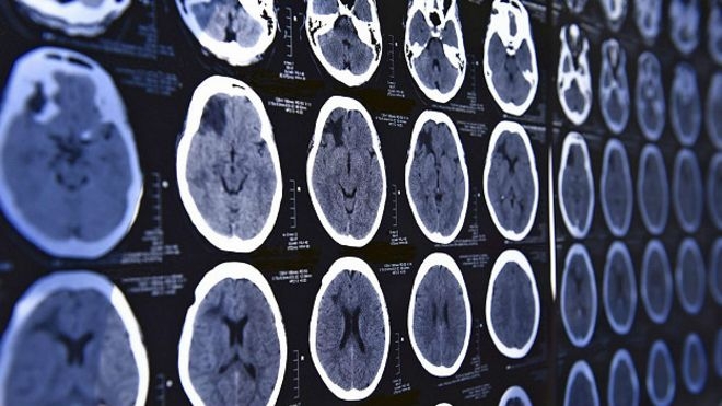 На полиграф рассчитывать нельзя. Может ли ваш собственный мозг уличить вас во лжи?