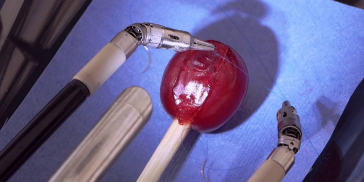 Робот-хирург может зашить даже лопнувшую виноградину