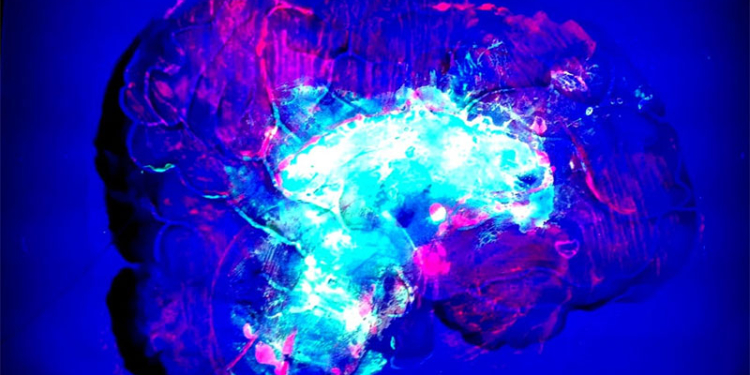 Картины, созданные кишечной палочкой