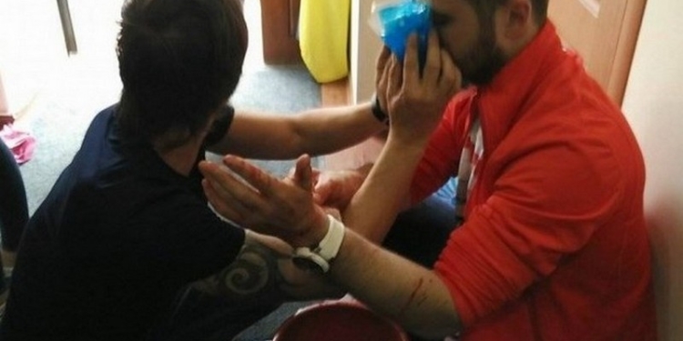 Стрельба по журналистам в Одессе: полиция узнала о причинах