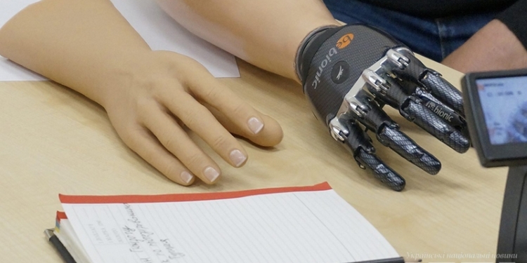 Воины АТО могут получать бионические протезы, не выезжая за границу