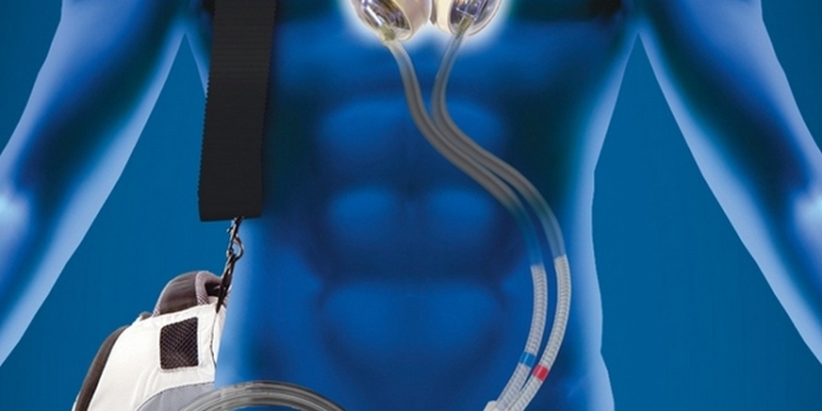 Американец полтора года жил с искусственным сердцем в рюкзаке