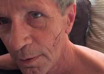 Канадец отбился от медведицы с помощью боксерских приемов