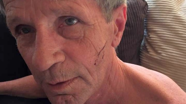 Канадец отбился от медведицы с помощью боксерских приемов