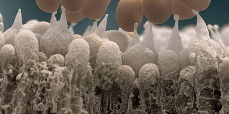 Грибы против людей. В Кривом озере невзлюбили производителя шампиньонов