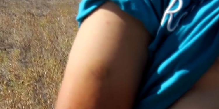 Врадиевка. Кривое Озеро. Следующая – Новая Одесса? Жители возмущены зверством полицейских, которые представляются бойцами полка «Азов»