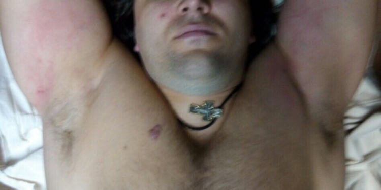 Аваков сообщил, что погибшая патрульная успела выстрелить в убийцу. Поэтому его и нашли в больнице