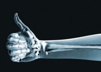 С помощью нанотехнологий создали технику для выявления переломов костей