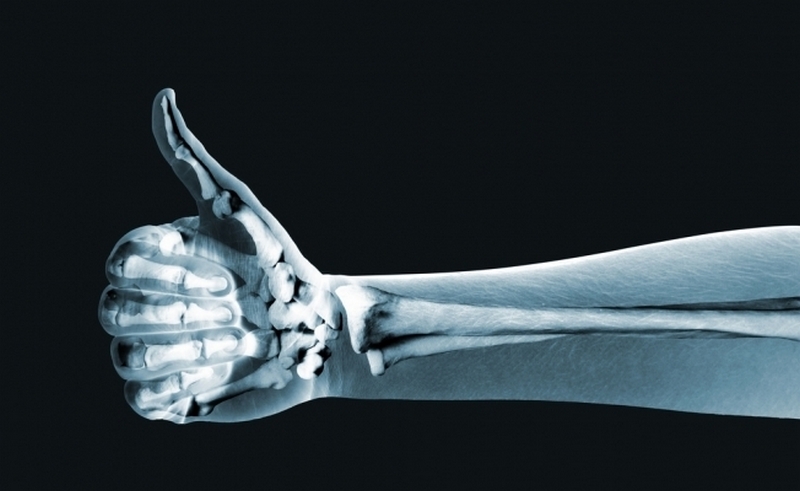 С помощью нанотехнологий создали технику для выявления переломов костей 1