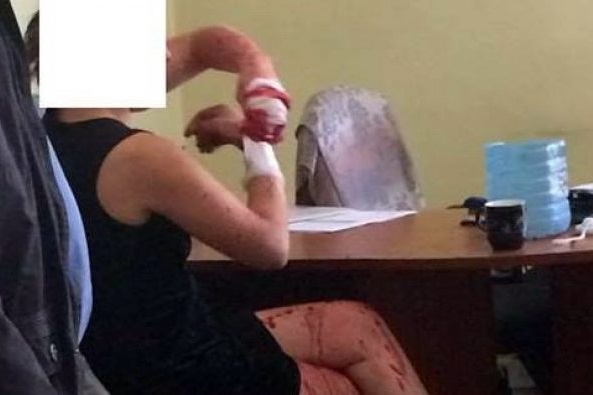 Россиянка во Львове разгромила РАГС и плеснула в работницу кислотой 4