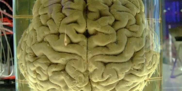 Выдающееся собрание умов: зачем бельгийской клинике 3000 мозгов в формалине?