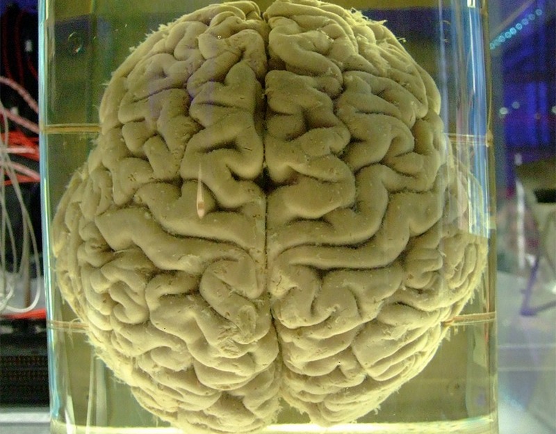 Британские ученые вырастили человеческий мозг в лаборатории 1