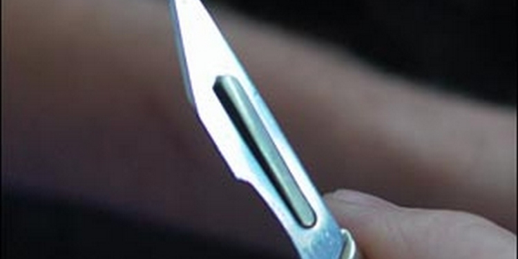 В Николаеве вместо того, чтобы расплатиться в магазине, мужчина достал скальпель